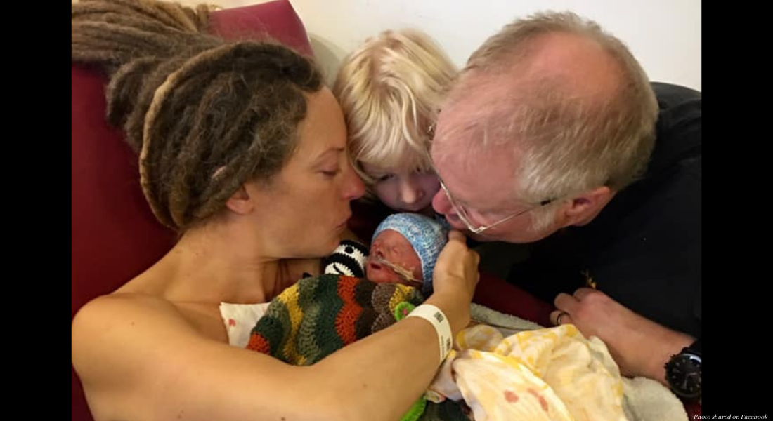 Trisomy 18