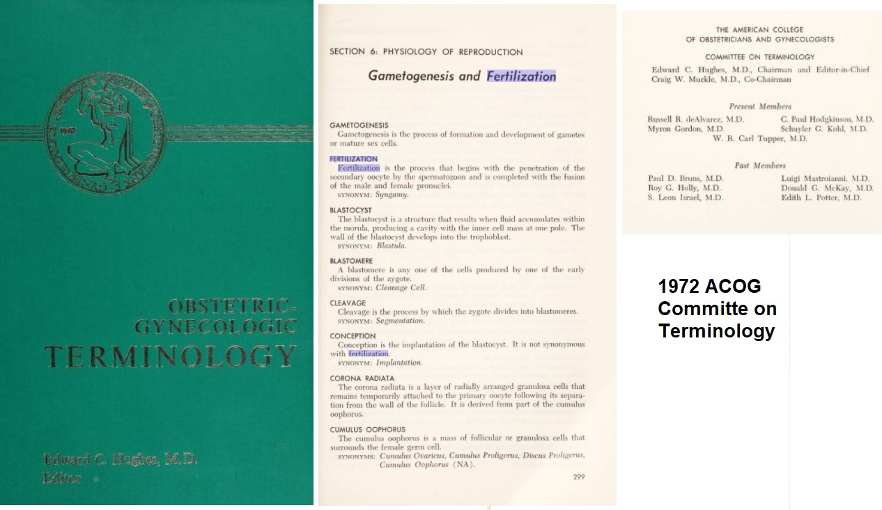 1972 ACOG committee on terminology changed definition of conception to implantation not fertilization