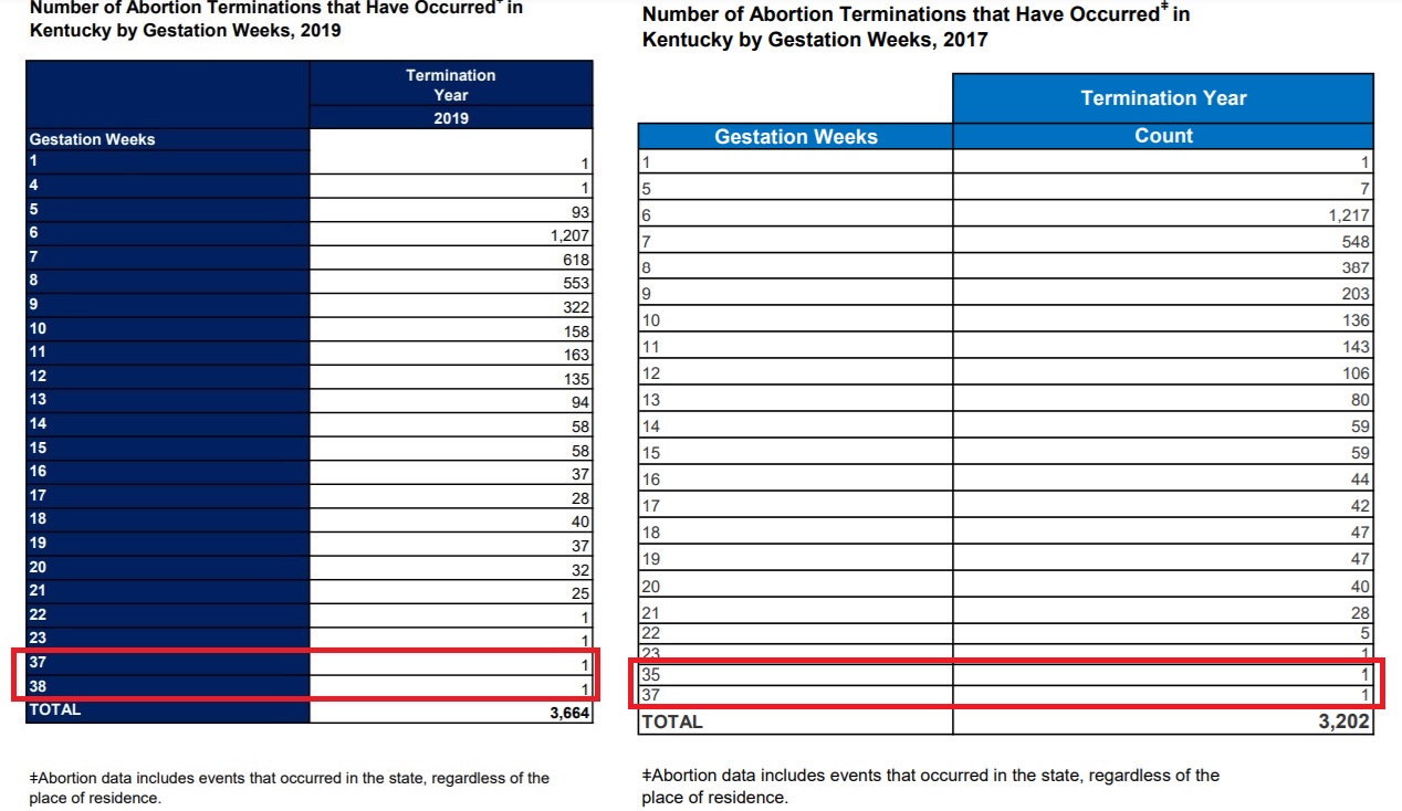 Image: KY babies aborted up to the day of birth at 35 to 37 weeks gestation Kentucky 2019 and 2017