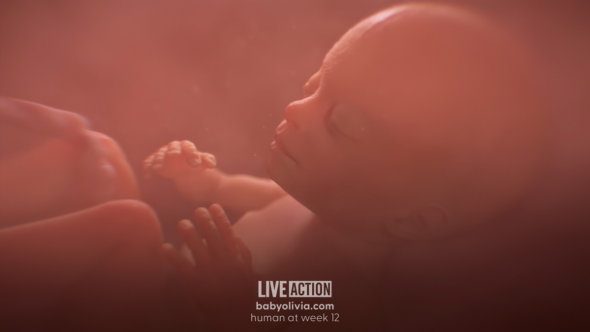 Baby Olivia, abortion