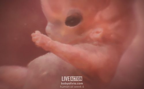 ‘Baby Olivia’ inspires multiple states to pass prenatal development education laws