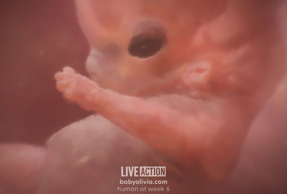 ‘Baby Olivia’ inspires multiple states to pass prenatal development education laws