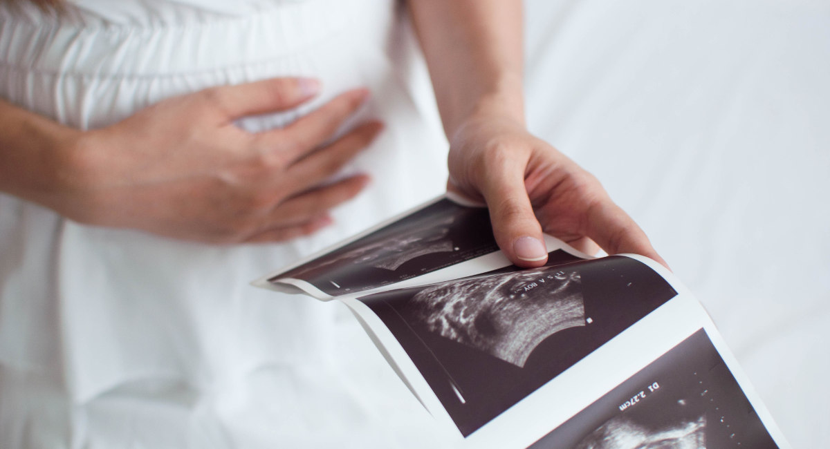 A pregnant woman is holding an ultrasound scan result