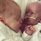 twins,
