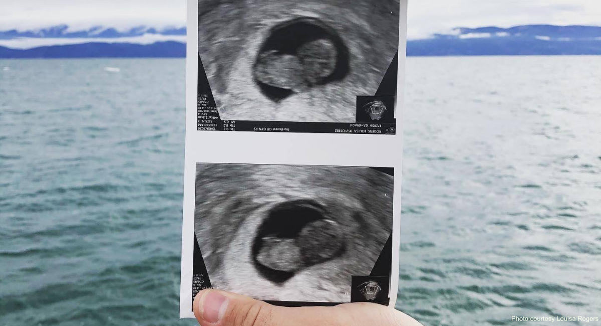 miscarriage, miscarried, ultrasound