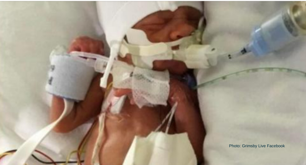 preemie