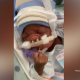 premature baby