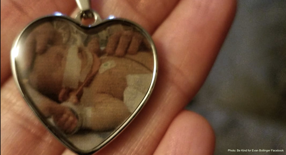 Trisomy 13