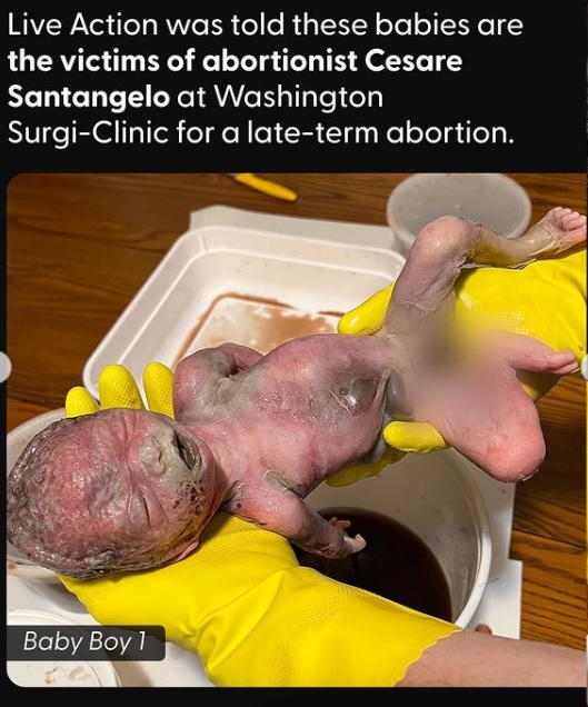 Photojournalism: Aborted babies found in DC infanticide alleged Baby Boy 1
