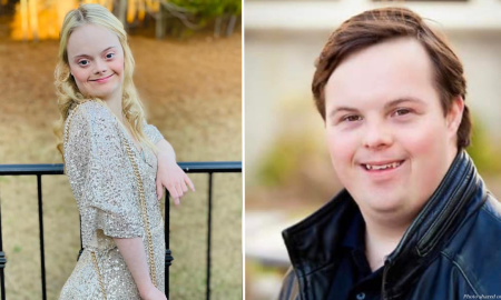 Down syndrome