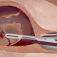 D&E abortionist