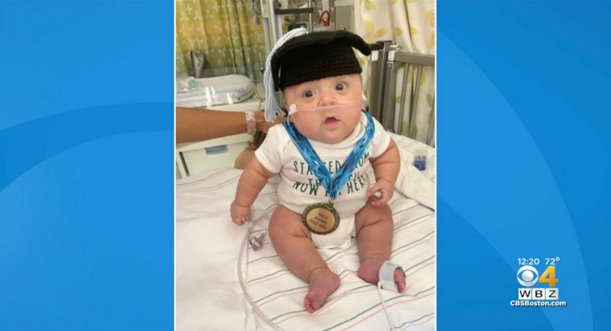 premature, 22 weeks
