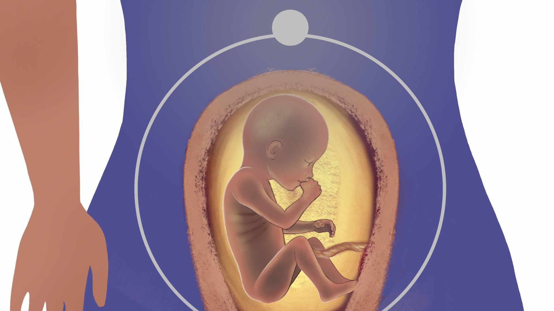 induction abortion screenshot