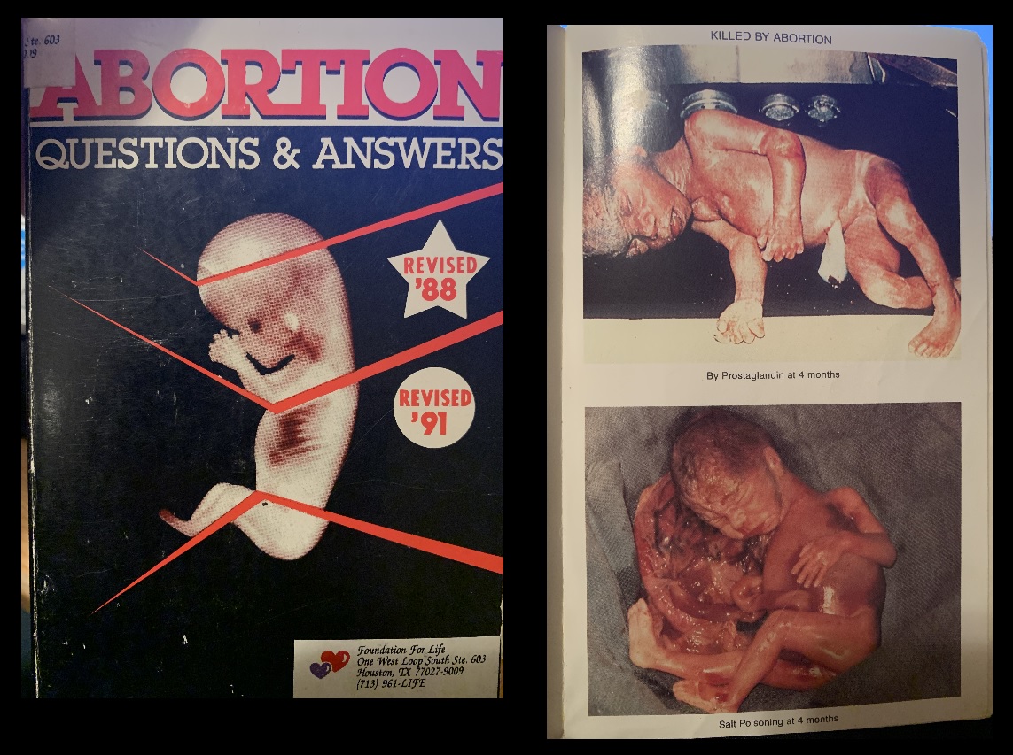 Image: Saline and prostaglandin abortion procedures (Images: Abortion Questions and Answers by J Willke)