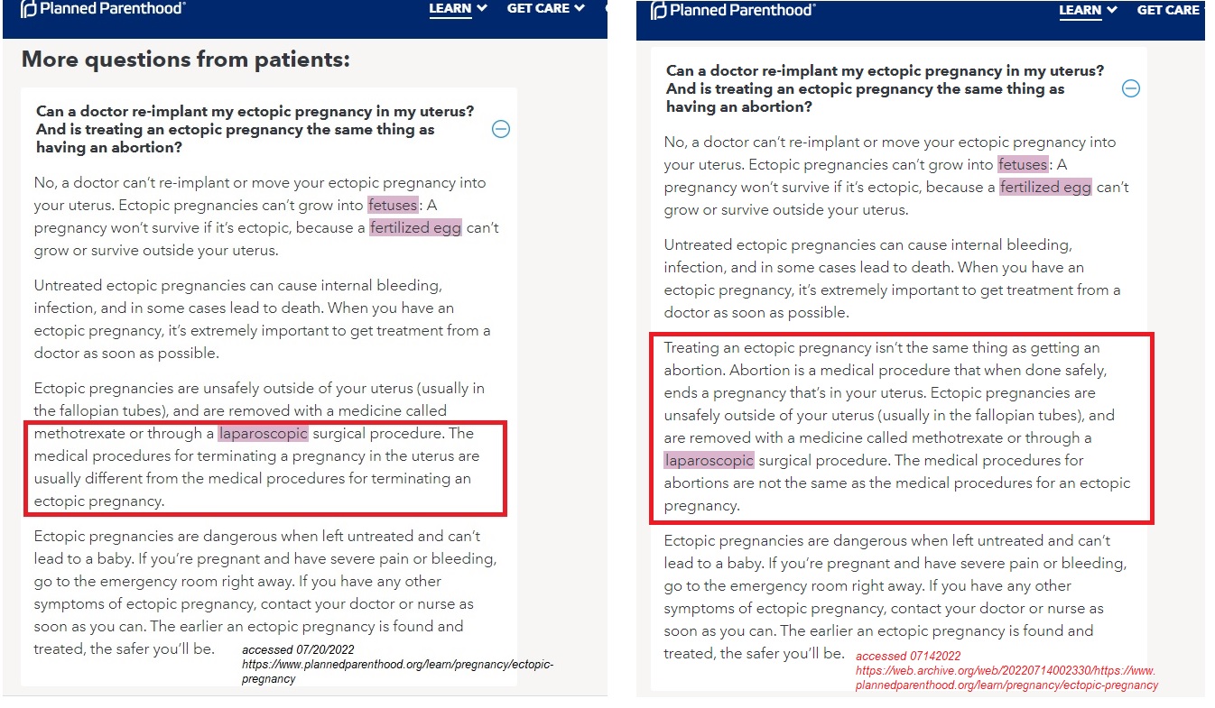 Image: Planned Parenthood ectopic pregnancy language change side by side (Accessed July 14 v July 20 of 2022)