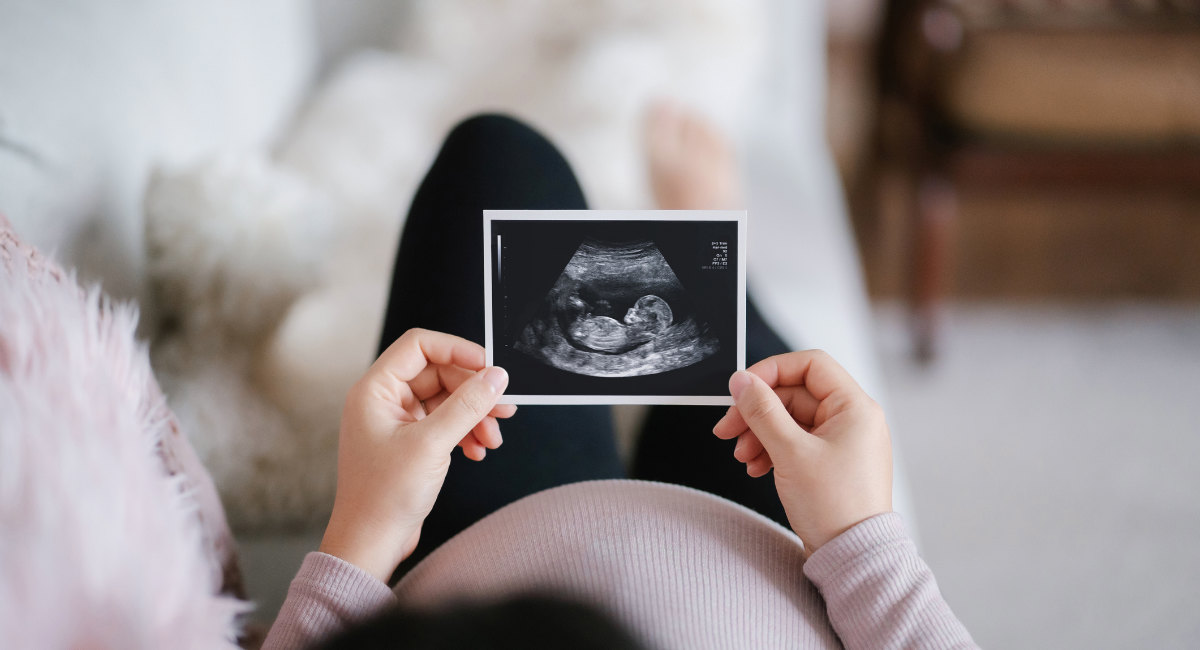 prenatal, abortion, down syndrome