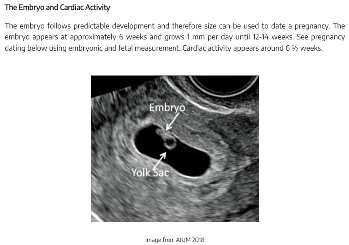 Image: Embryo has cardiac activity by 6 weeks (TEACH abortion training curriculum, 2022) 