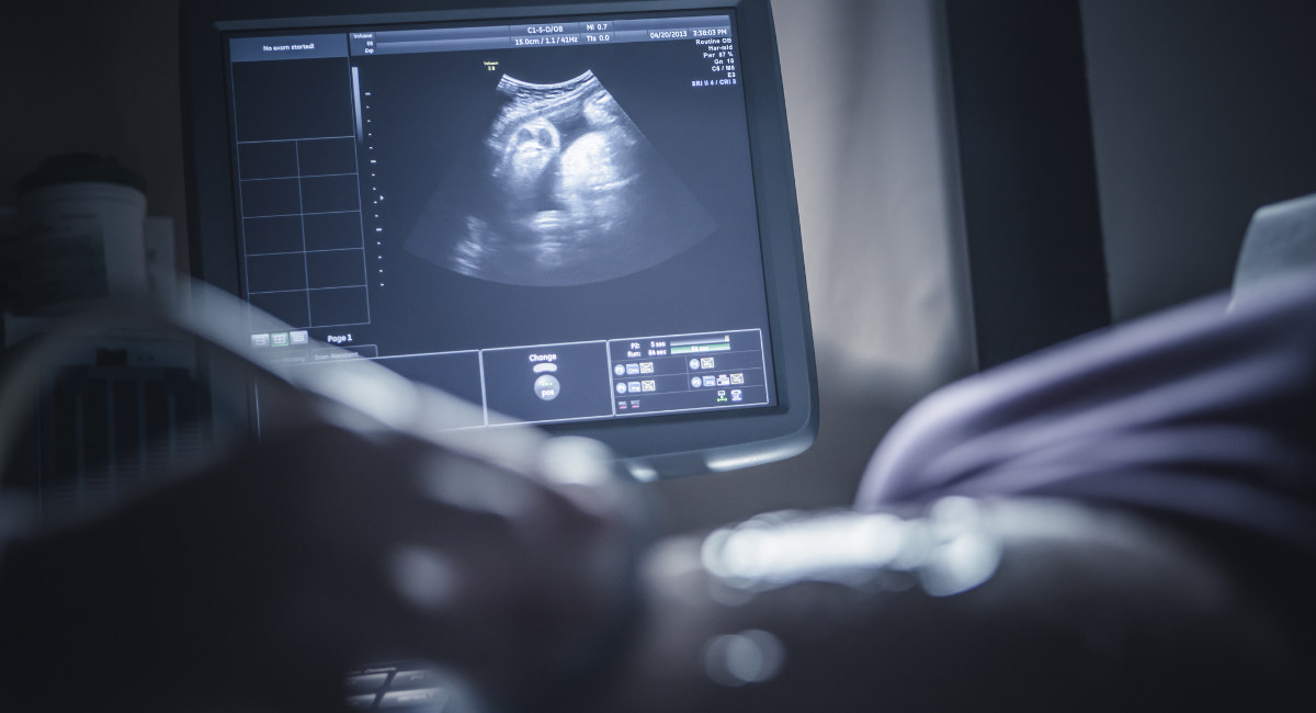 ultrasound, abortion, Polish