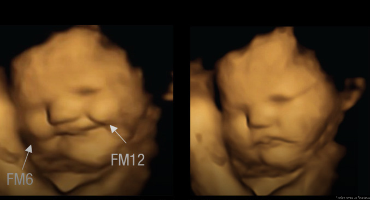 preborn