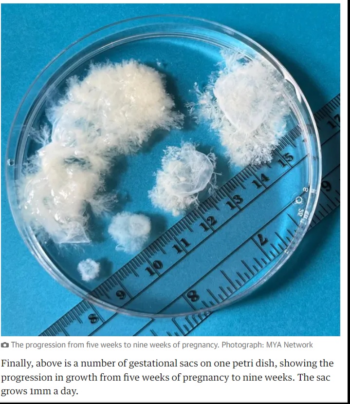 Image: Guardian fetal images progression 5 to 9 weeks (Photograph: MYA Network)