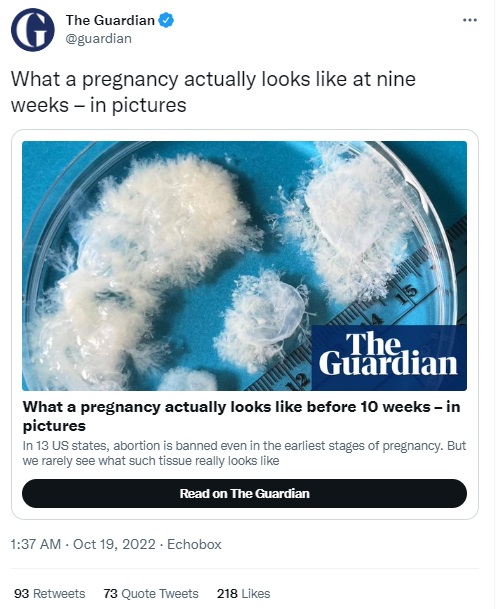 Image: The Guardian article misleading fetal tissue images of baby at nine weeks of pregnancy (Image: Twitter)