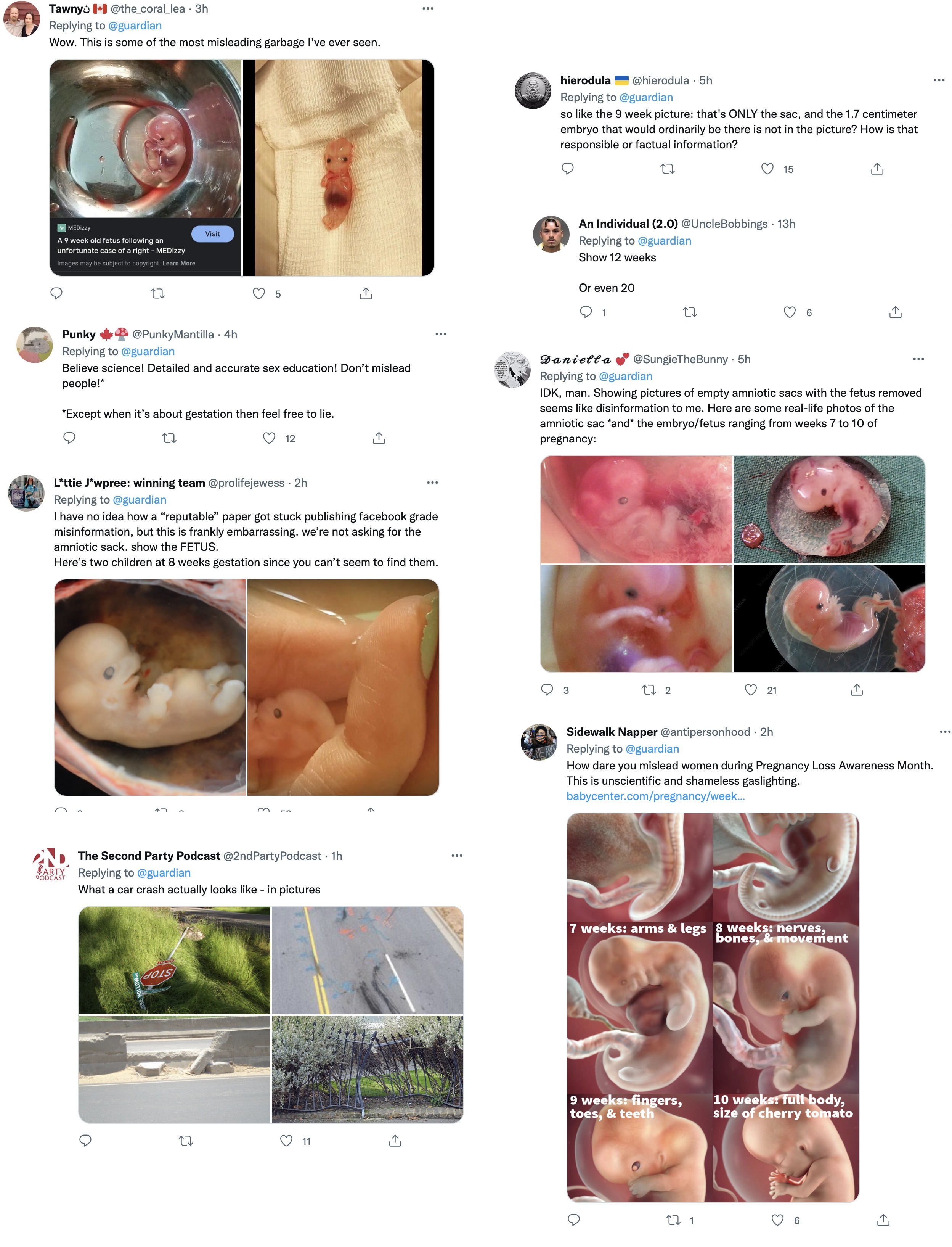 Image: Responding to misinformation by Guardian on abortion and fetal images (Images: Twitter)