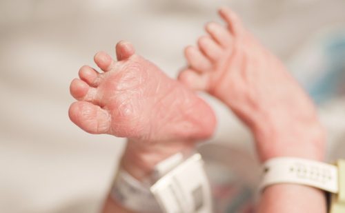Born more than 3 months early, baby Landon is home after a year in the hospital