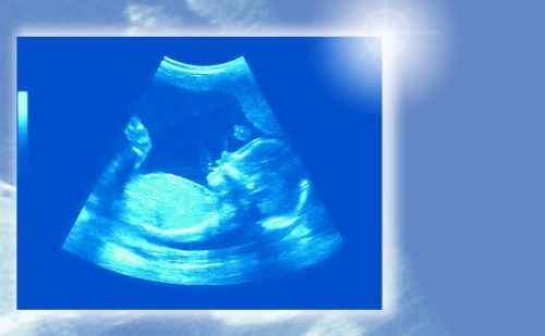 Montana Family Foundation sues over constitutional amendment on abortion