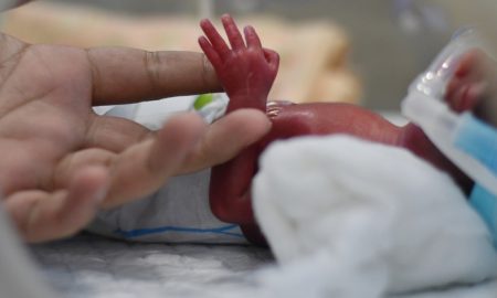 abortion survivors, premature, preemie