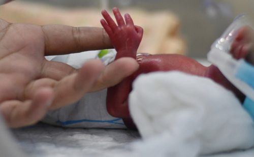 More babies born at 22 weeks are surviving, but it’s still legal to kill them