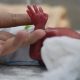 abortion survivors, premature, preemie,