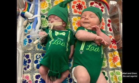 twins, trisomy 18, abortion