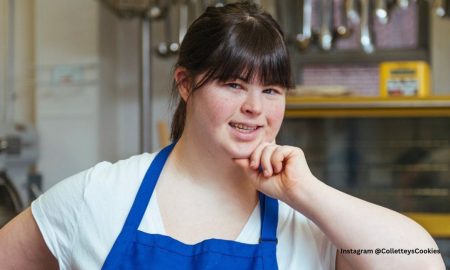 Down syndrome, Collette