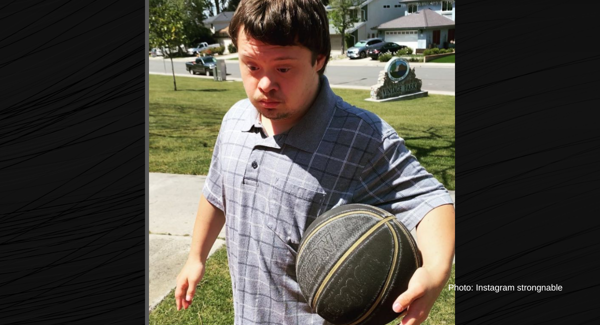 Down syndrome