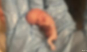 abortion, abortion pill