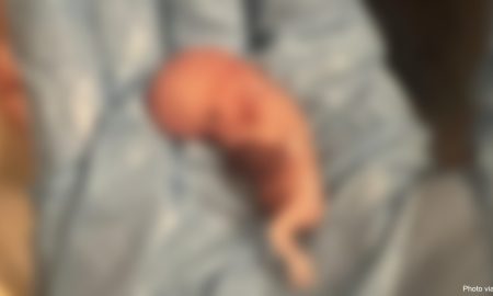 abortion