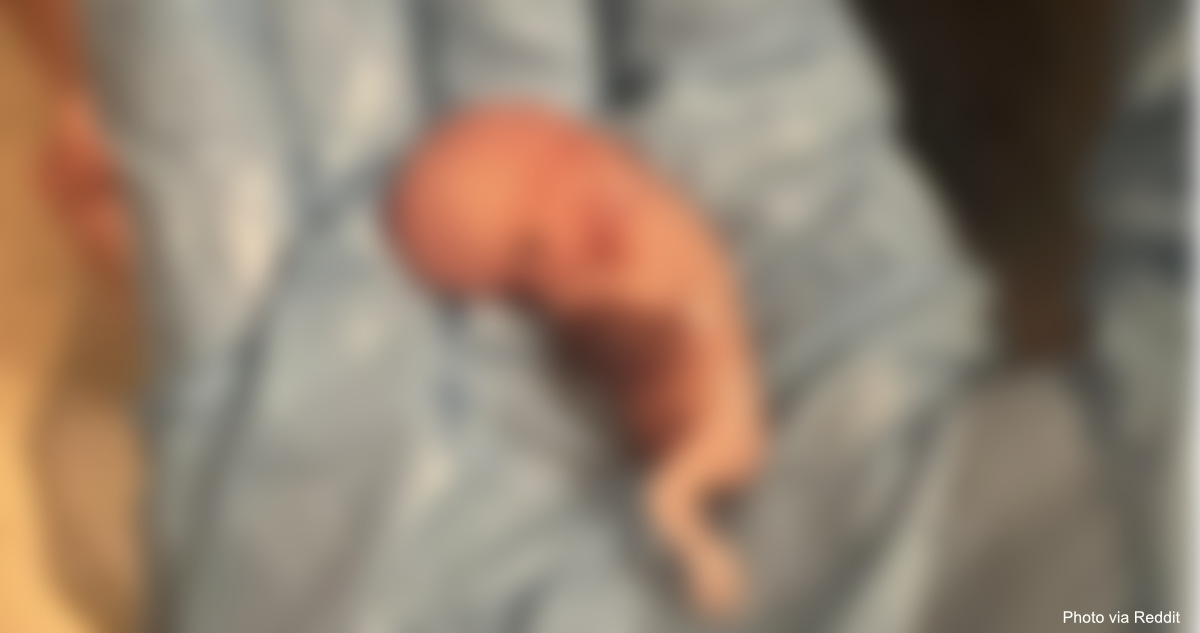 abortion