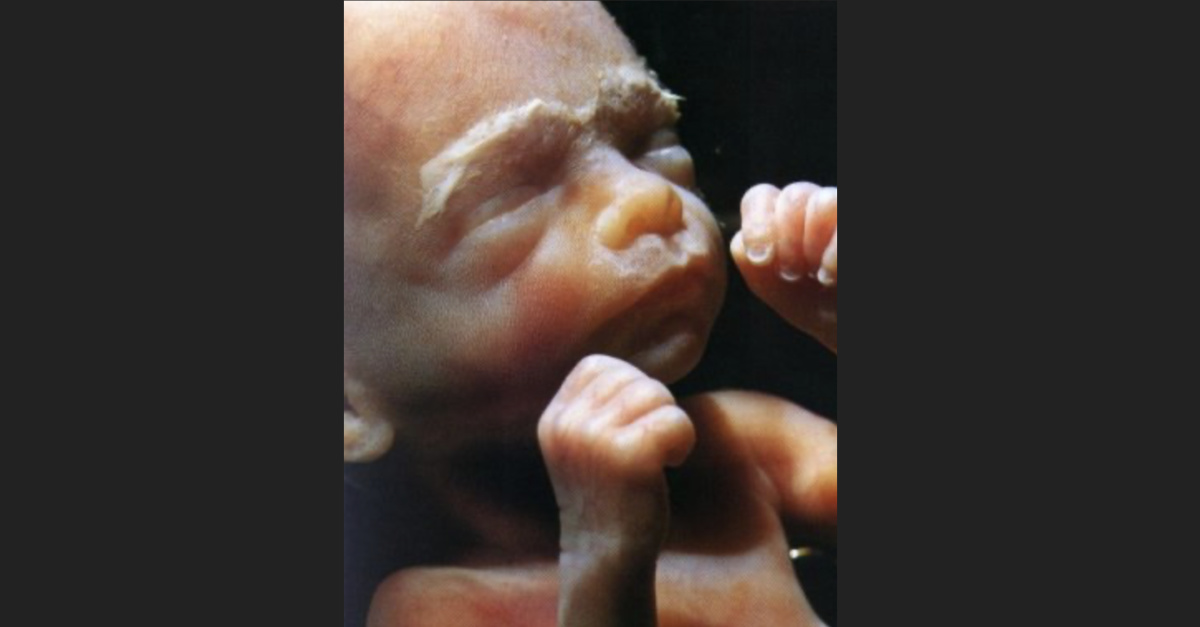 abortion