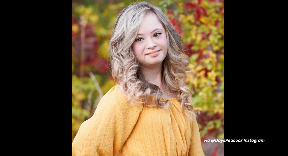 Down syndrome, days of our lives