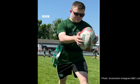 Down syndrome