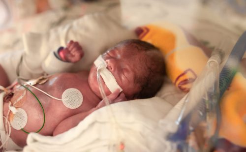 Preemie goes home after spending first 14 months after birth in hospital