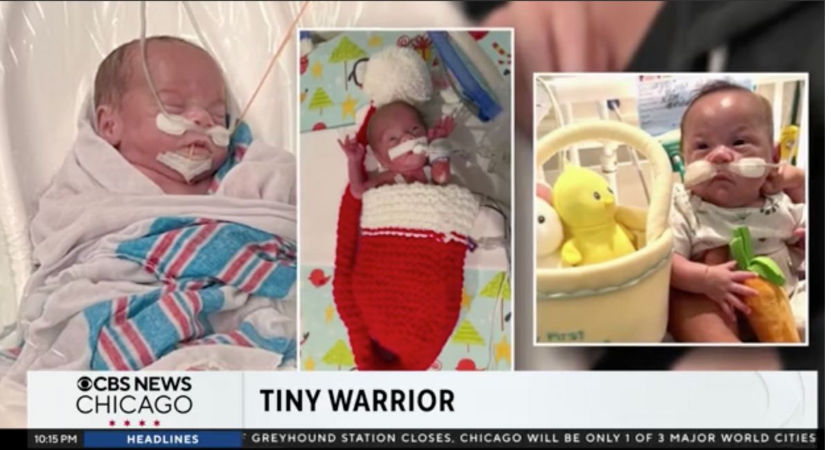 NICU, premature, newborn