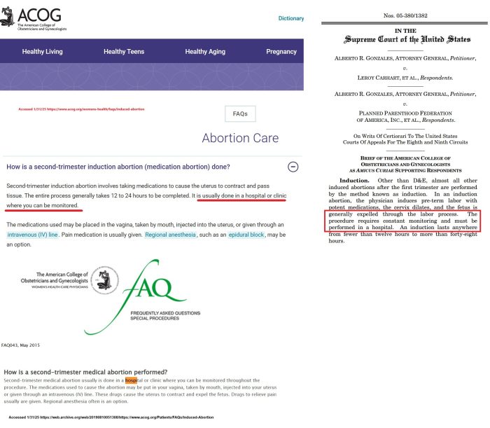 ACOG on induction abortion website (2011+2015) v amicus brief