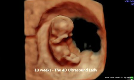 abortion pill reversal
