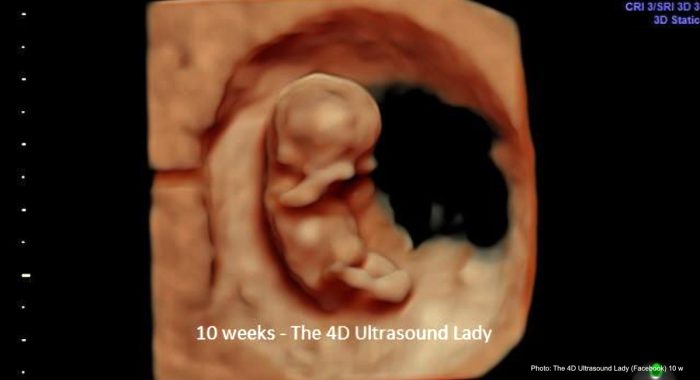 abortion pill reversal