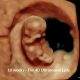 abortion pill reversal