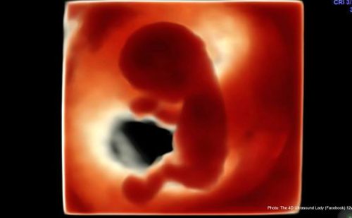 Nation of Jersey sees increased abortions for second year in a row