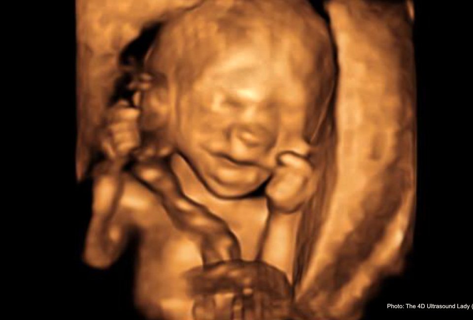 Late-term abortionist’s document: Carrying to term safer for women than abortion at 18+ weeks