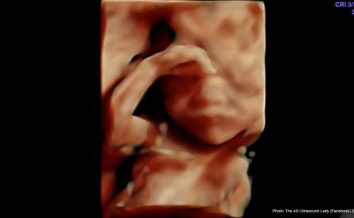 Wisconsin’s only ‘independent’ abortion biz hopes to eventually kill babies after 20 weeks