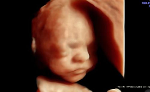 Is new ‘all-trimester’ Illinois abortion business breaking state law?